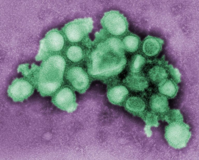 Gripe porcina o gripe A en el embarazo: Los riesgos aumentan