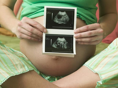 Cuántas ecografías se hacen en el embarazo