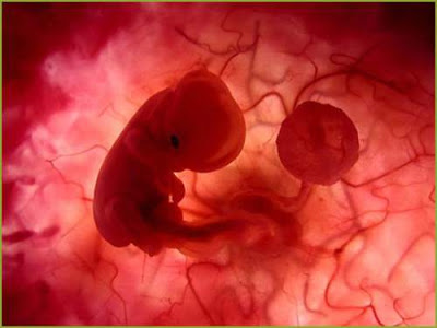 5 preguntas y respuestas sobre el aborto espontáneo