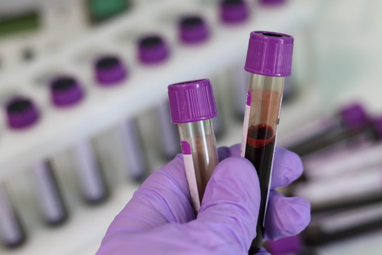 Prueba de embarazo en sangre