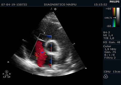 Ecocardiografía fetal ecocardiografia-fetal