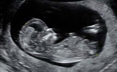 bebe-ecografia-ultrasonido